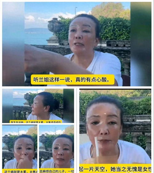 张兰白癜风病情控制住了，战胜病魔的秘诀与启示