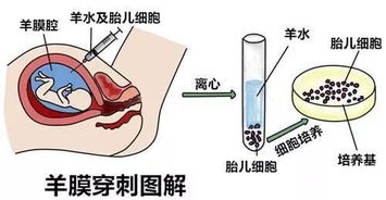 胎儿性别测试，了解你的选择