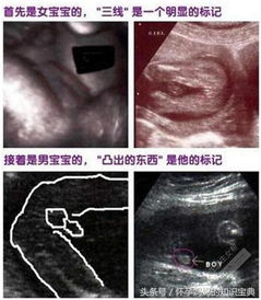 胎心率与胎儿性别，科学还是迷信？