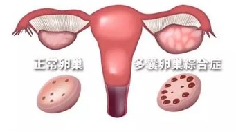 克罗米芬怎么吃生双胞胎