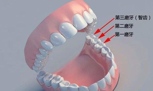 长智齿牙龈肿痛的应对策略与家庭护理指南