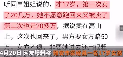 烧伤妈妈康复之路，家属深情呼吁，让爱以另一种方式延续