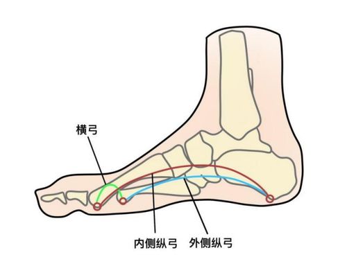 长期穿矫正鞋垫有用吗？——育儿专家的全面解析