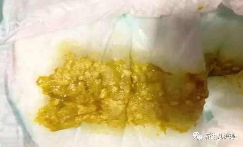 宝宝换奶粉后便秘？家长必看的应对指南