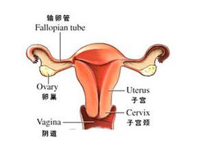 盆腔积液的症状、成因及对育儿的影响