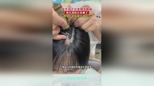 女生头顶头发稀少？别担心，这里有全面的解决方案！