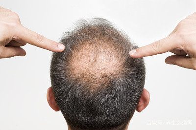 头发掉得好厉害怎么办？全面解析脱发原因与应对策略